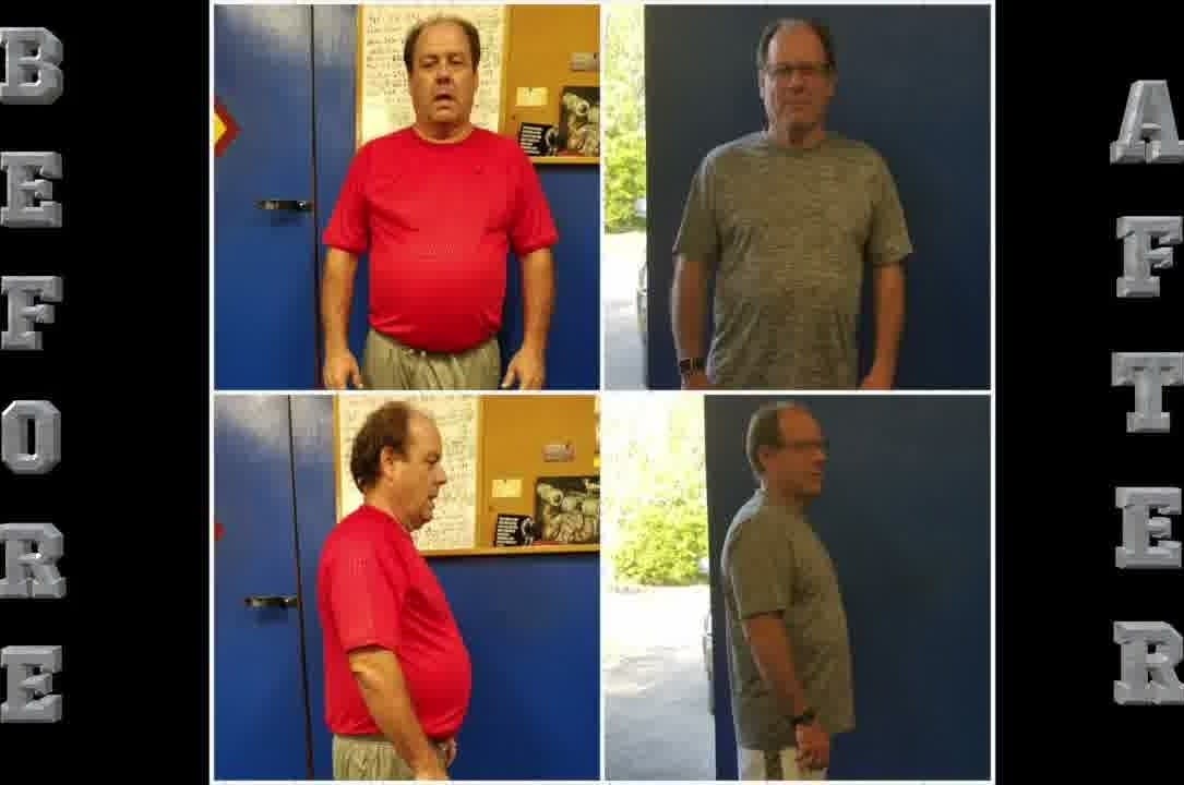 Client before-and-after transformation, front and side comparison